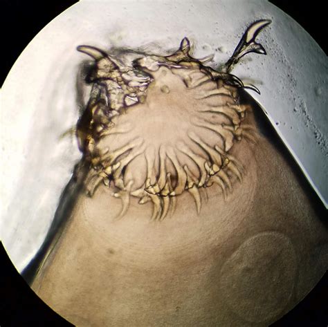 Tapeworm Ultrasound at Nancy Ramirez blog