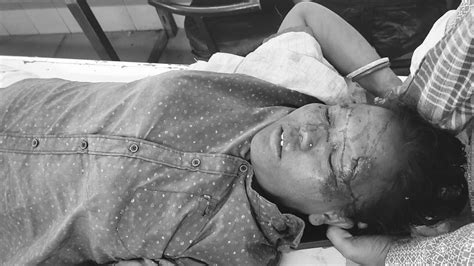 Adityapur accident - आदित्यपुर टोल ब्रिज के समीप कार के धक्के से स्कूटी ...