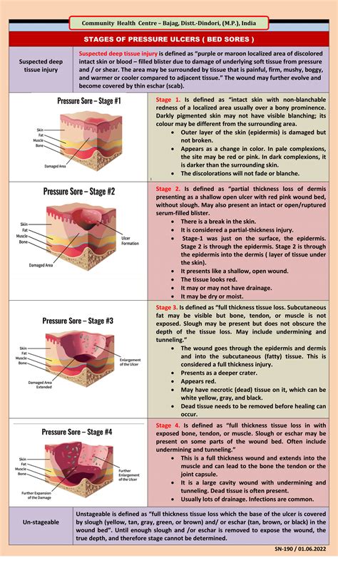 Medical Notes For Students: Pressure Ulcers - Stages