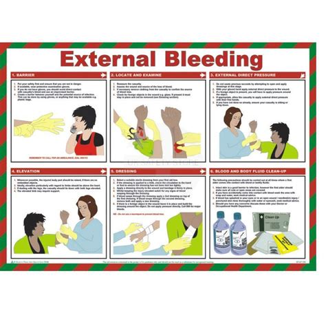 First Aid Heavy Bleeding 的图像结果