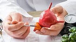 Prostate Cancer Diagnosis Through Urine Test In AIIMS Bhopal