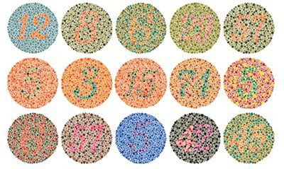 COMPUTER VISION SYNDROME II- PATIENT ASSESSMENT