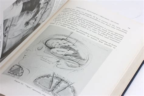 PSYCHOSURGERY In The Treatment Of Mental Disorders And Intractable Pain ...