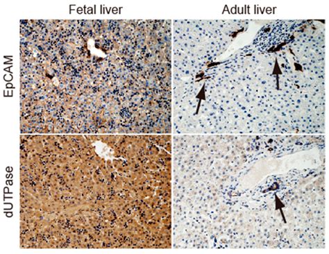 Beta-Hydroxyisovaleryl-Shikonin Eradicates Epithelial Cell Adhesion ...