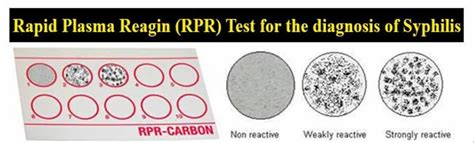 RPR Testing 的图像结果