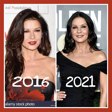 Catherine Zeta Jones Face Surgery