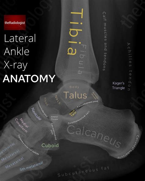 Foot and Ankle X-Ray Guide – the Radiologist