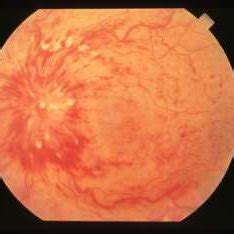 Image Object Normal 的图像结果