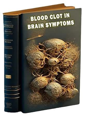 Blood Clot in Brain Symptoms: Understand the signs of a blood clot in ...