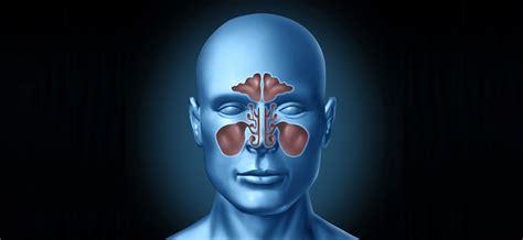 Odontogenic Sinusitis: Tooth-Related Sinus Infection - Prof. Dr. Gediz ...