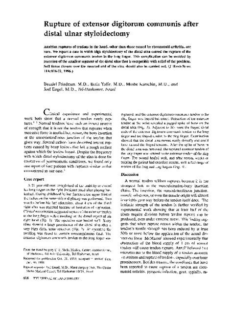 Image result for Extensor Digitorum Communis Surgery