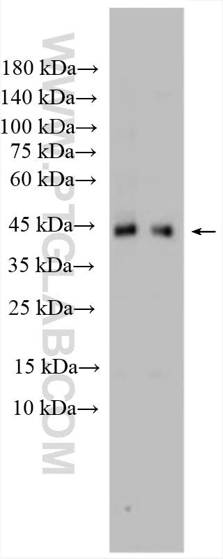 TGF beta 1 antibody (26155-1-AP) | Proteintech