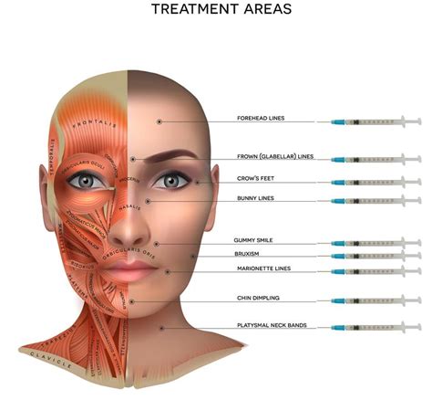 Botox Services 的图像结果