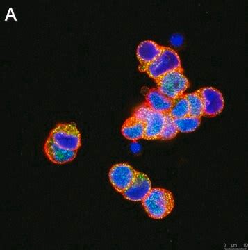 Anti-Rhodopsin Antibody, clone 5D17 ZooMAb® Rabbit Monoclonal ...