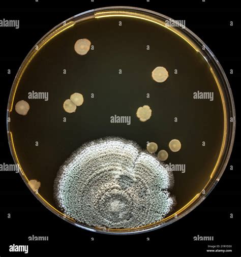 Close-up of bacterial and fungal colonies growing on an agar plate ...