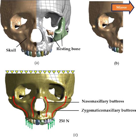 Table 2 from Design of a Metal 3D Printing Patient-Specific Repairing Thin Implant for ...