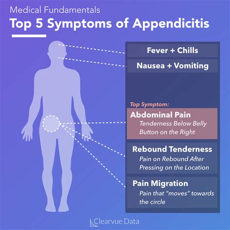 The Data on Appendicitis Without Surgery