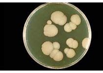 真菌学国家重点实验室在“超级真菌”感染的防治方面取得新进展 - 生物研究专区 - 生物谷