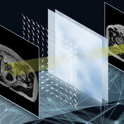 Image result for Deep Learning Algorithm for Image Analysis