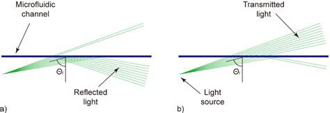 Diagnostics | Special Issue : Microfluidic Lab-on-a-Chip Platforms for ...