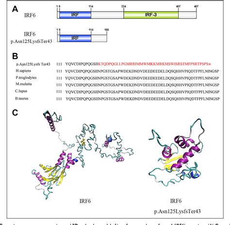 Figure 2 from A Novel IRF6 Frameshift Mutation in a Large Chinese Pedigree With Van der Woude ...