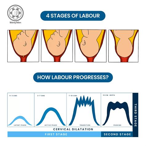 Stages And Phases Of Labor