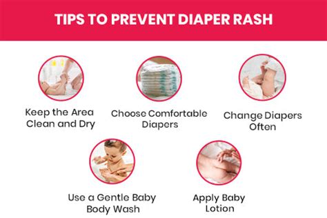 Home Remedies to Soothe and Heal Diaper Rash Naturally