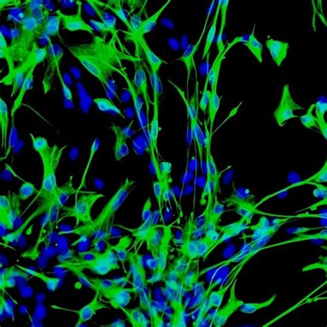 Human Brain Stem Astrocytes - Innoprot Primary Neural Cell System