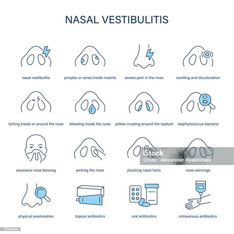 Nasal Vestibulitis Symptoms Diagnostic And Treatment Vector Icon Set Stock Illustration ...