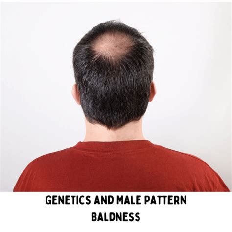 Hair Fall in Men: Causes and Solutions | Clinikally