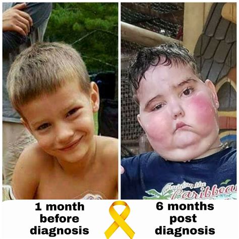 DIPG Brain Stem, Brain Tumor, Child Life, Diagnosis, Cancer, Supportive ...