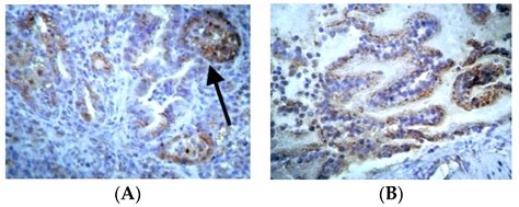 Erythropoietin Reduces Inflammation, Oxidative Stress, and Apoptosis in ...