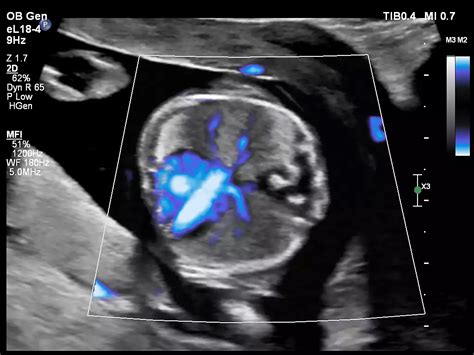 Philips - Affiniti 70 Ultrasound system