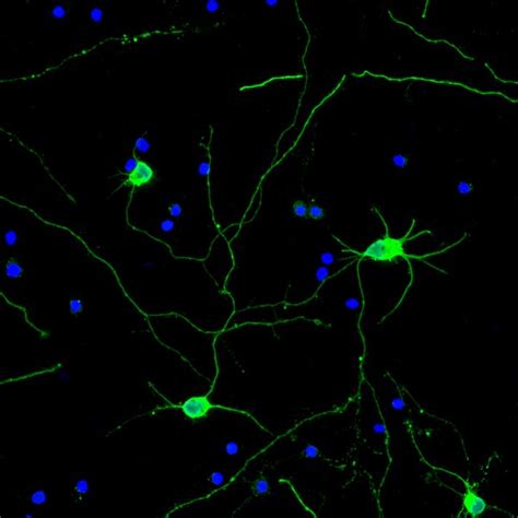 Neuro-Chrom™ Pan Neuronal Marker Antibody-Rabbit, Alexa488 conjugate ...