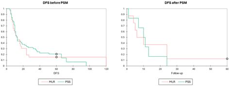 Can We Achieve More with Less? Parenchymal Sparing Surgery Versus Major ...