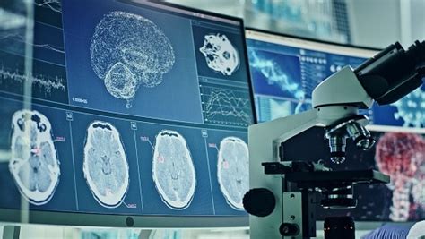 Over 7 million stroke deaths every year linked to air pollution, high ...