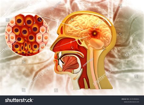 Image result for Brain Decimation