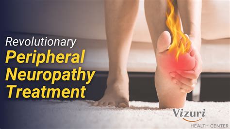 How To Cure Neuropathy In The Feet at Audrey Stier blog