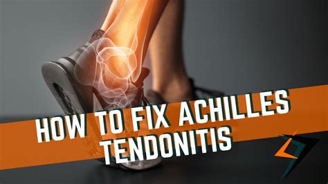 Running With Achilles Tendonitis UK Online | www.pinnaxis.com