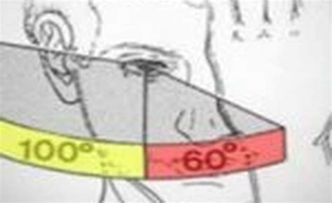 Image result for Check Visual Fields