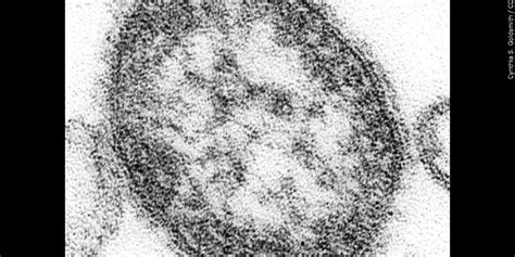 The measles outbreak could last for a year, according to experts