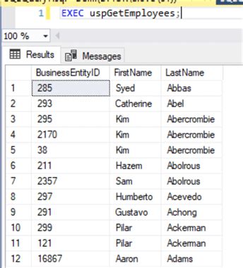 Image result for SQL Stored Procedures Logo
