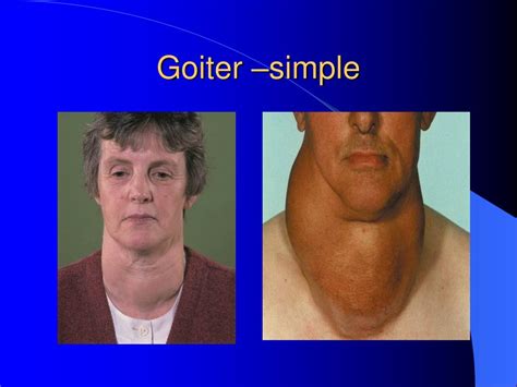 Image result for Thyroid Function Algorithm
