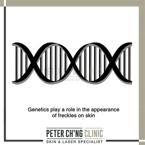 5 Facts About Freckles You Didn’t Know | Peter Ch'ng Skin Specialist ...