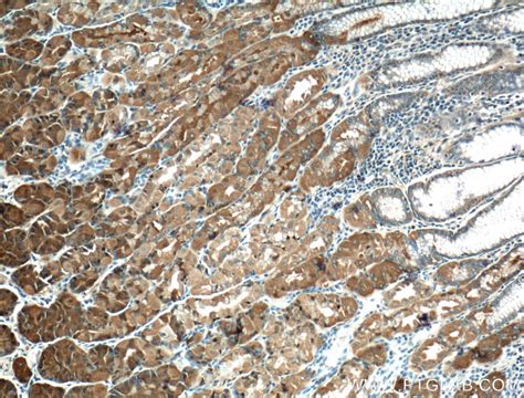 RNF135 antibody (25061-1-AP) | Proteintech