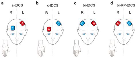 Reversed Polarity bi-tDCS over M1 during a Five Days Motor Task ...