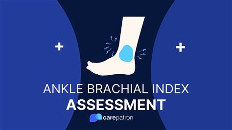 Ankle-Brachial Index Procedures Using Unit IX 的图像结果