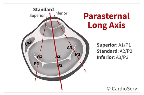 Mitral Valve Orientation in Echo: Anatomy & Scallops Expained!