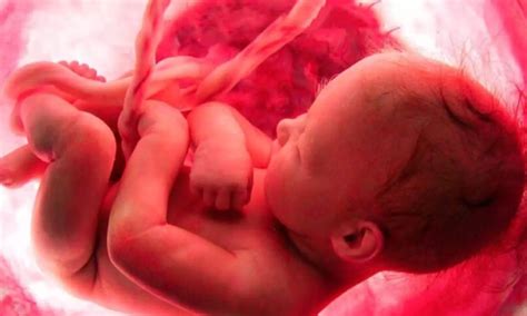 Higher APOA4 Levels in Umbilical Cord Blood Linked to Maternal ...