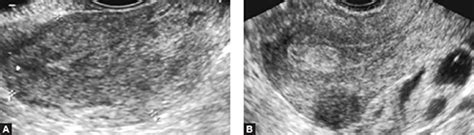 JaypeeDigital | eBook Reader